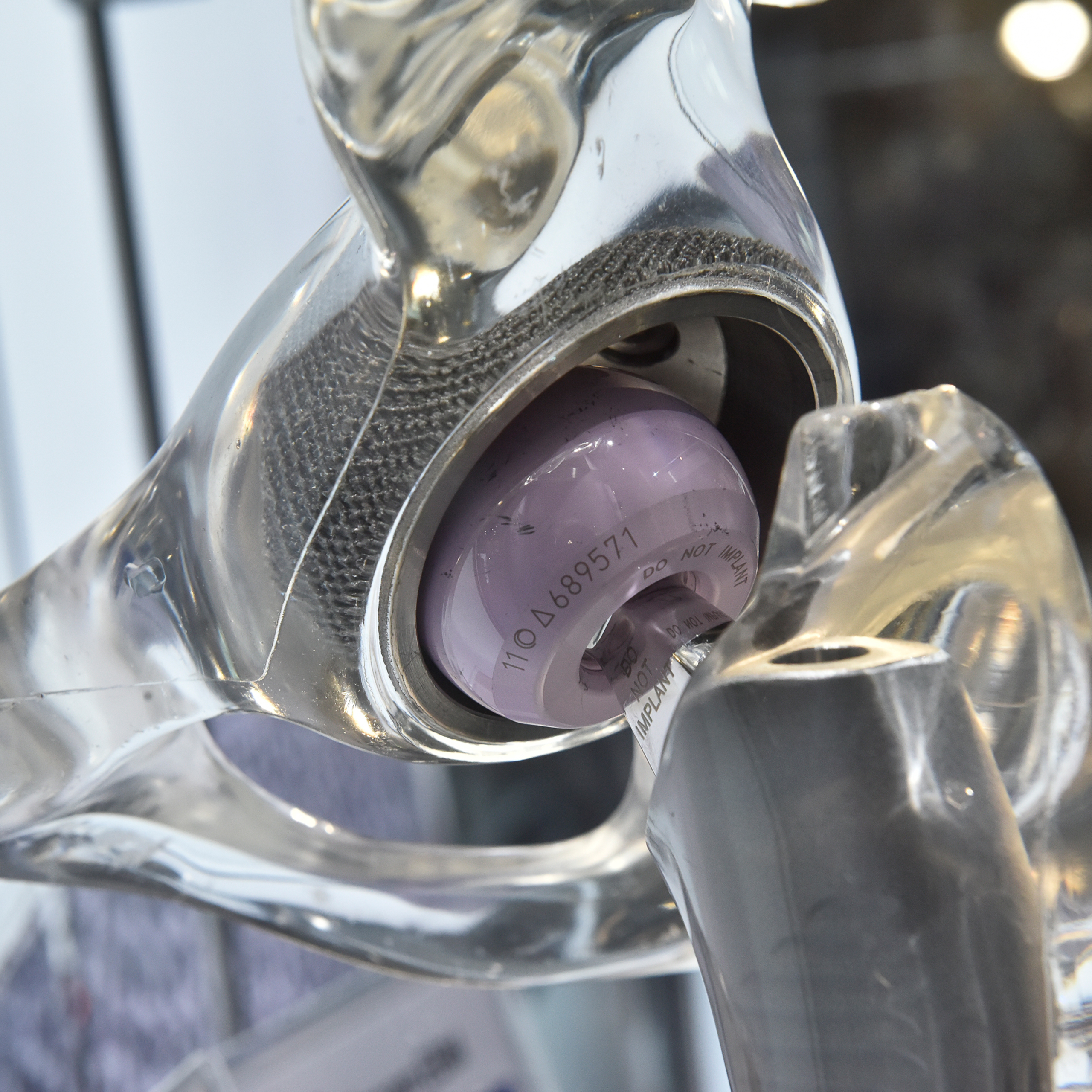 From implants to organs