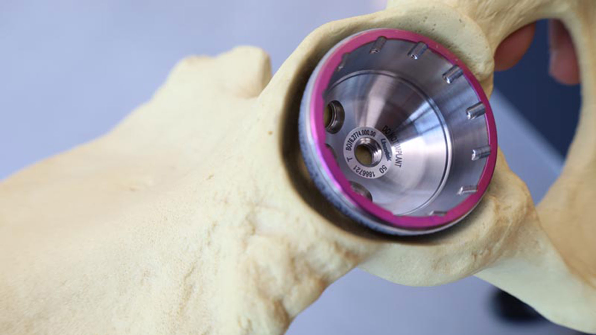 A 3D-printed joint socket. Picture: Thomas Masuch