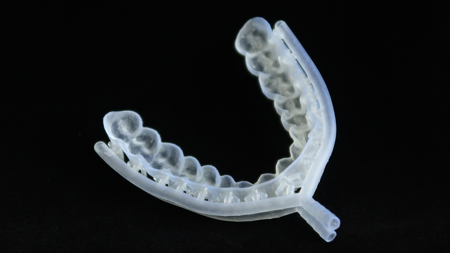 Prototype_View_Splint