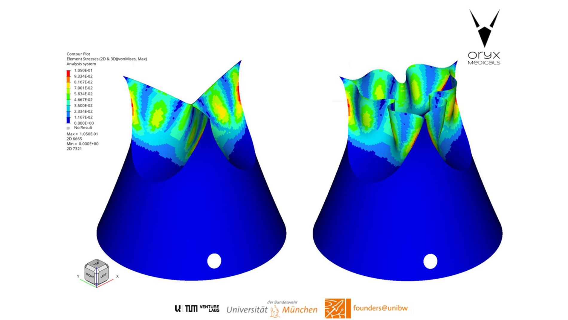 Structural and fluid-dynamic optimization for the additvely manufactured TAVI heart valve