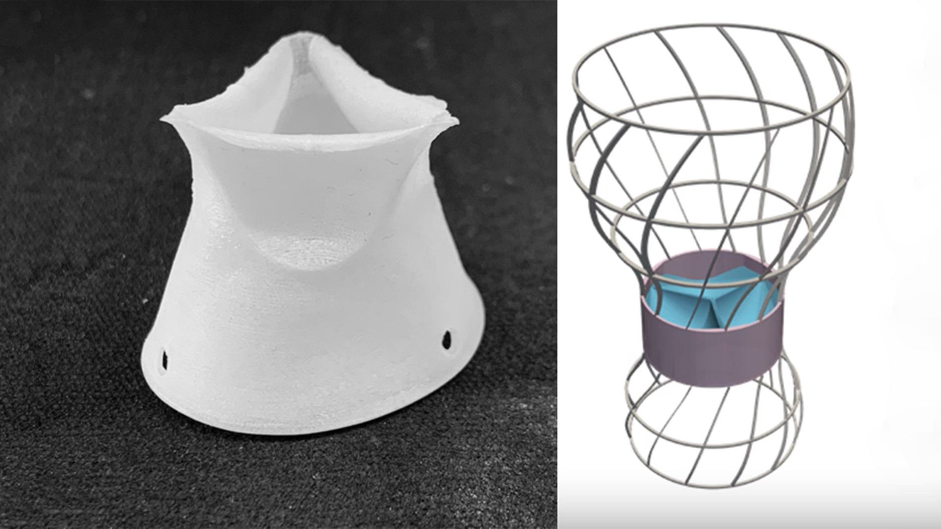 Additively Manufactured Heart Valve for TAVI