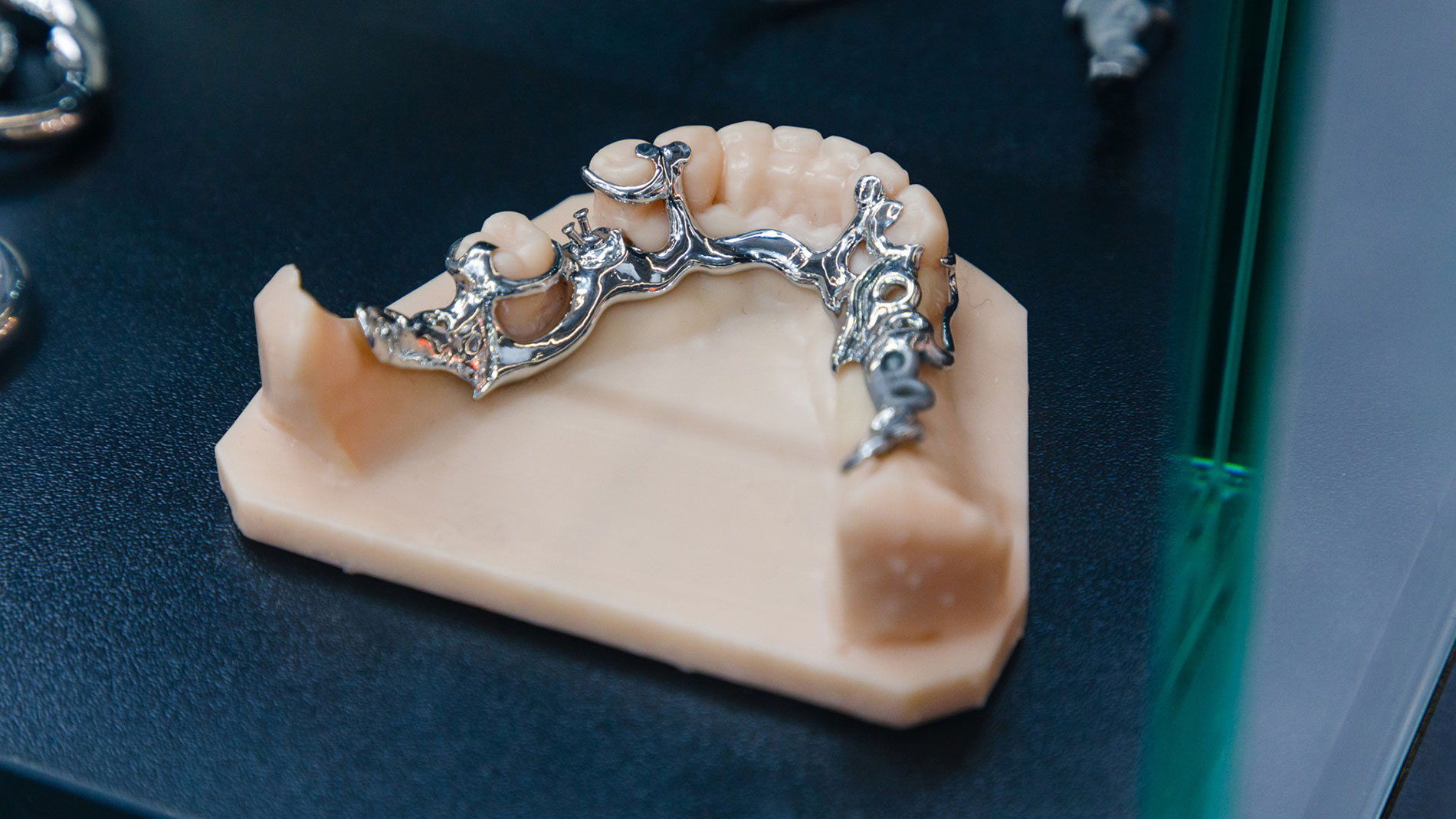 3D-printed implants have proven themselves in medicine for years.  Image: Mesago Marc Jacquemin