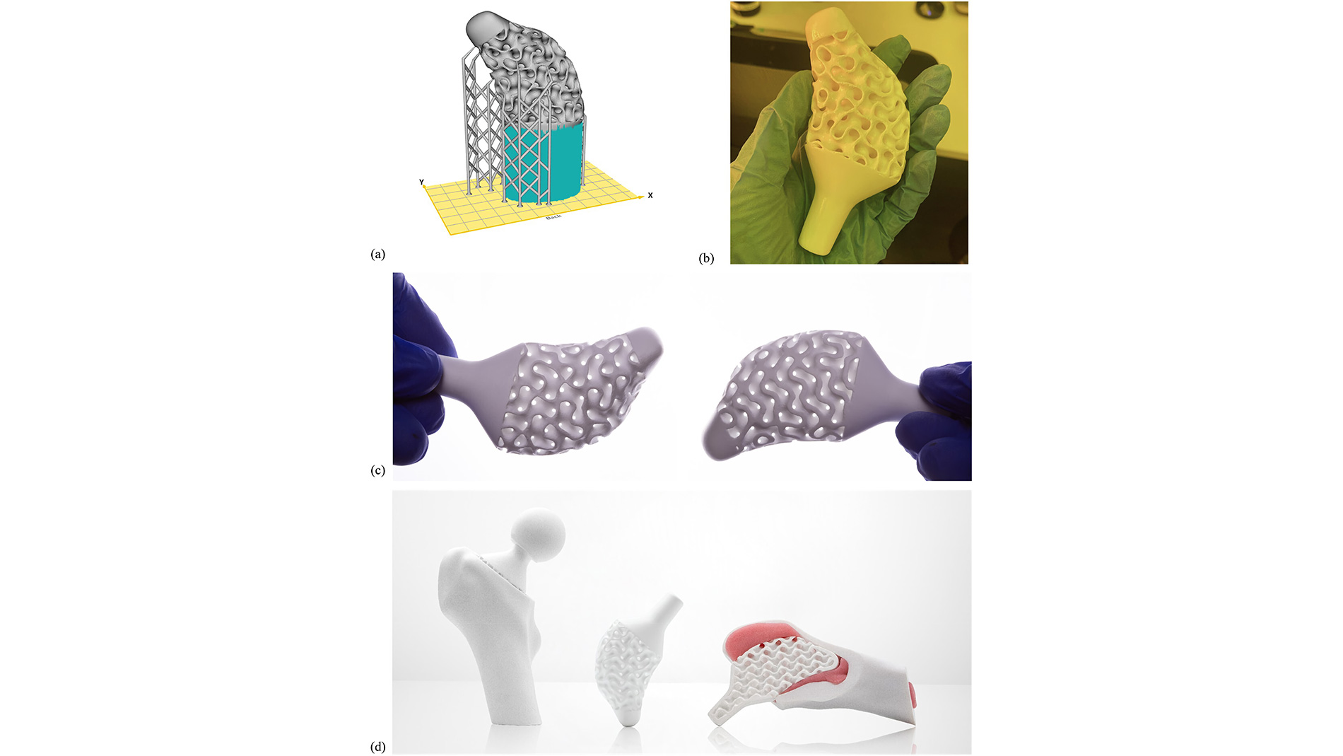 A short-stem hip prosthesis leaves the printer as a green body (b) and gains its final properties only through debinding and sintering (d). Attribution: Solórzano-Requejo et al., Virtual and Physical Prototyping 2024, 19, e2387280, CC BY 4.0.